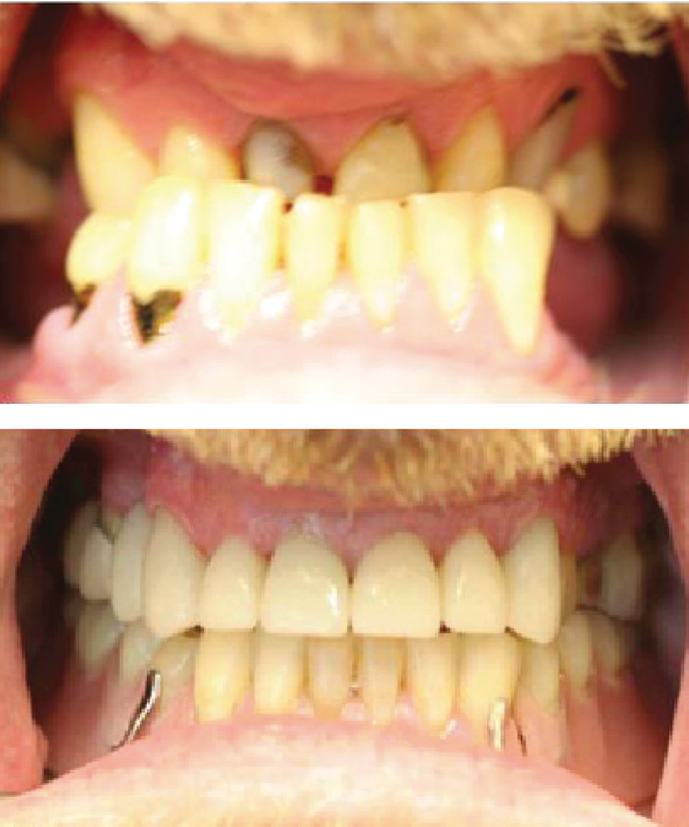 Renton Dentist Office