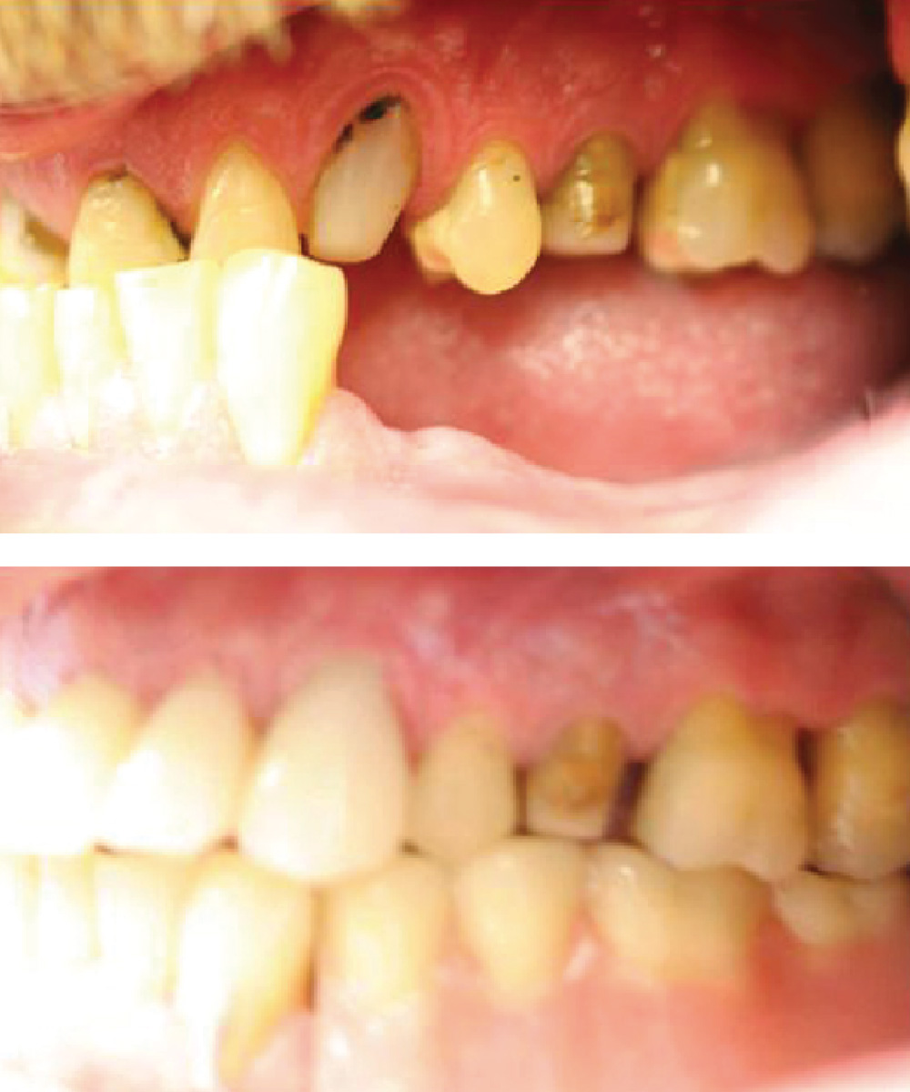 Renton Dentist Office