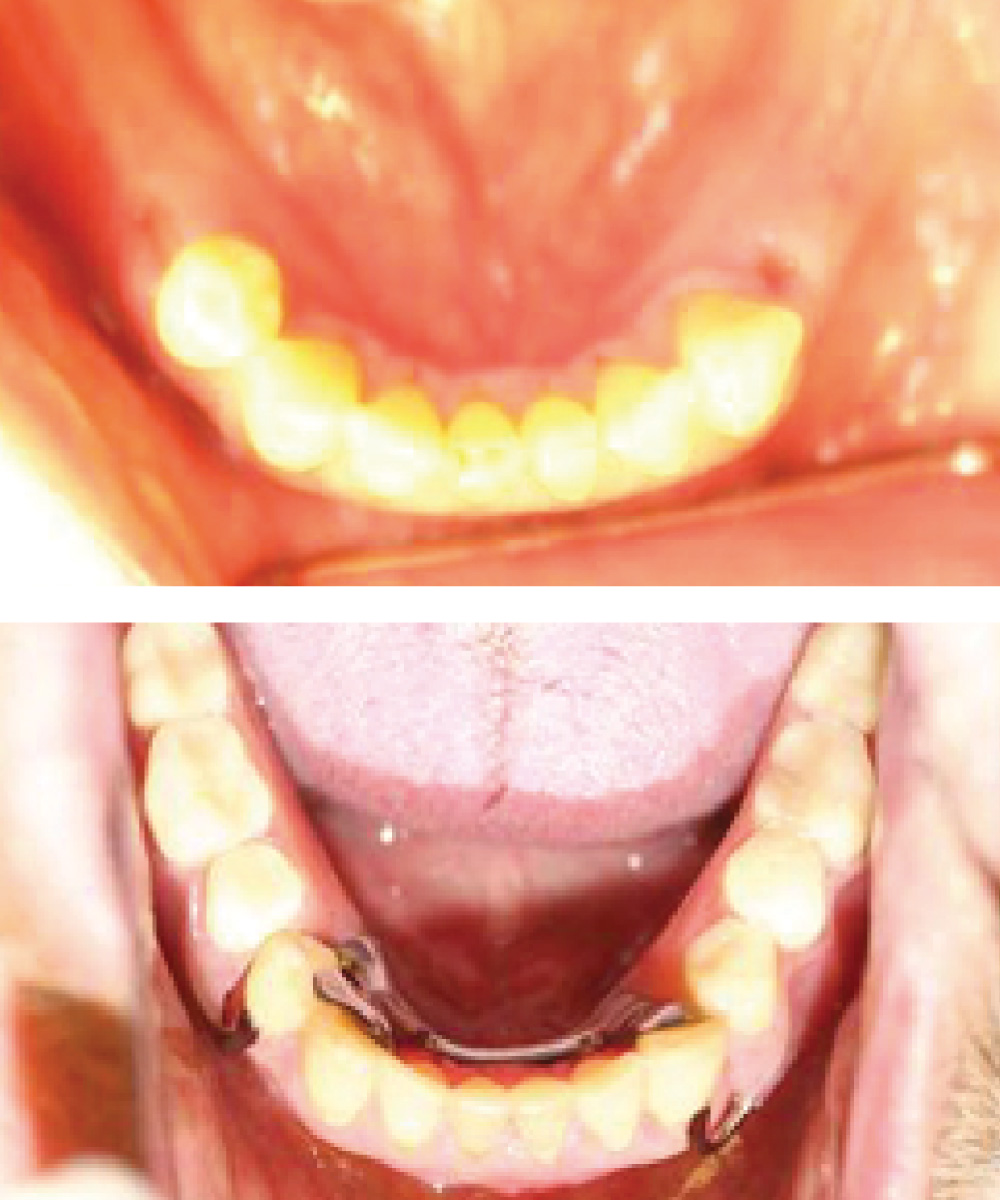 Renton Dentist Office