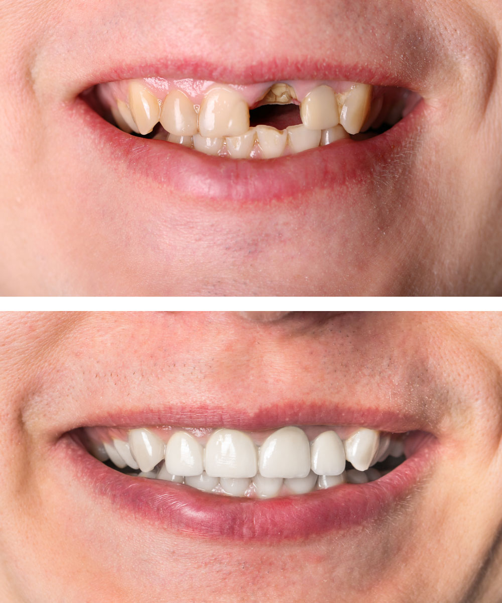 Renton Dentist Office