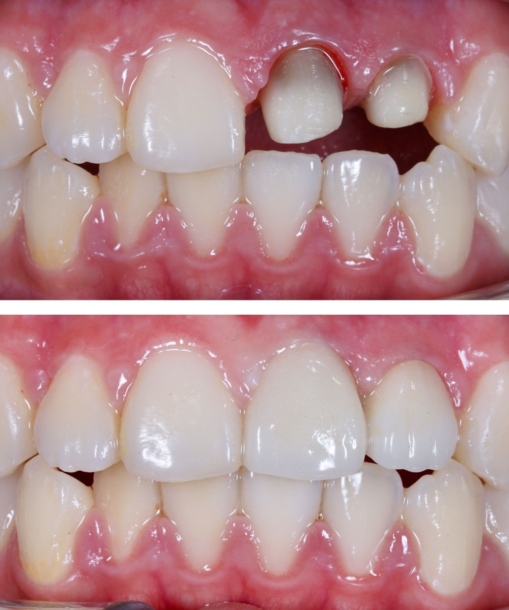 Renton Dentist Office