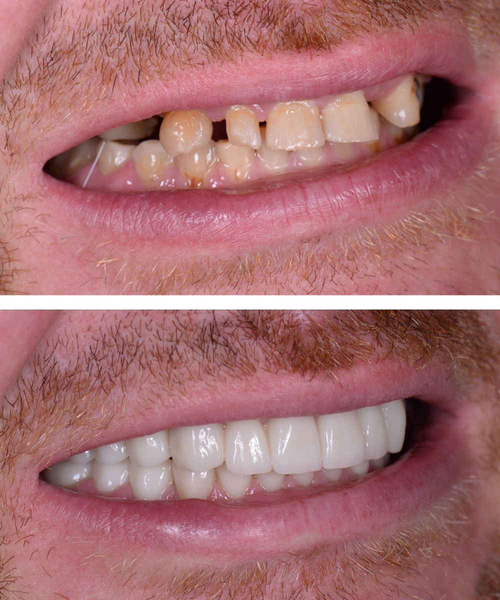 Renton Dentist Office