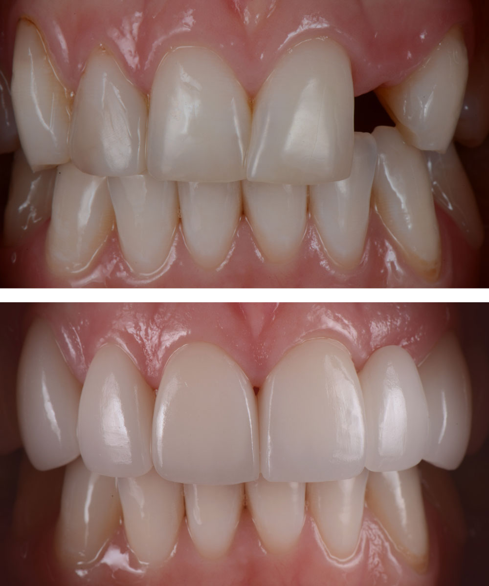 Renton Dentist Office