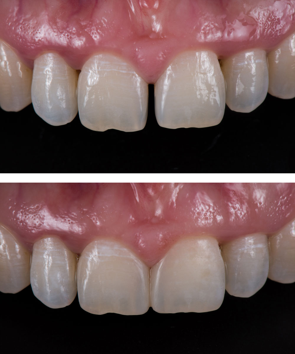 Renton Dentist Office