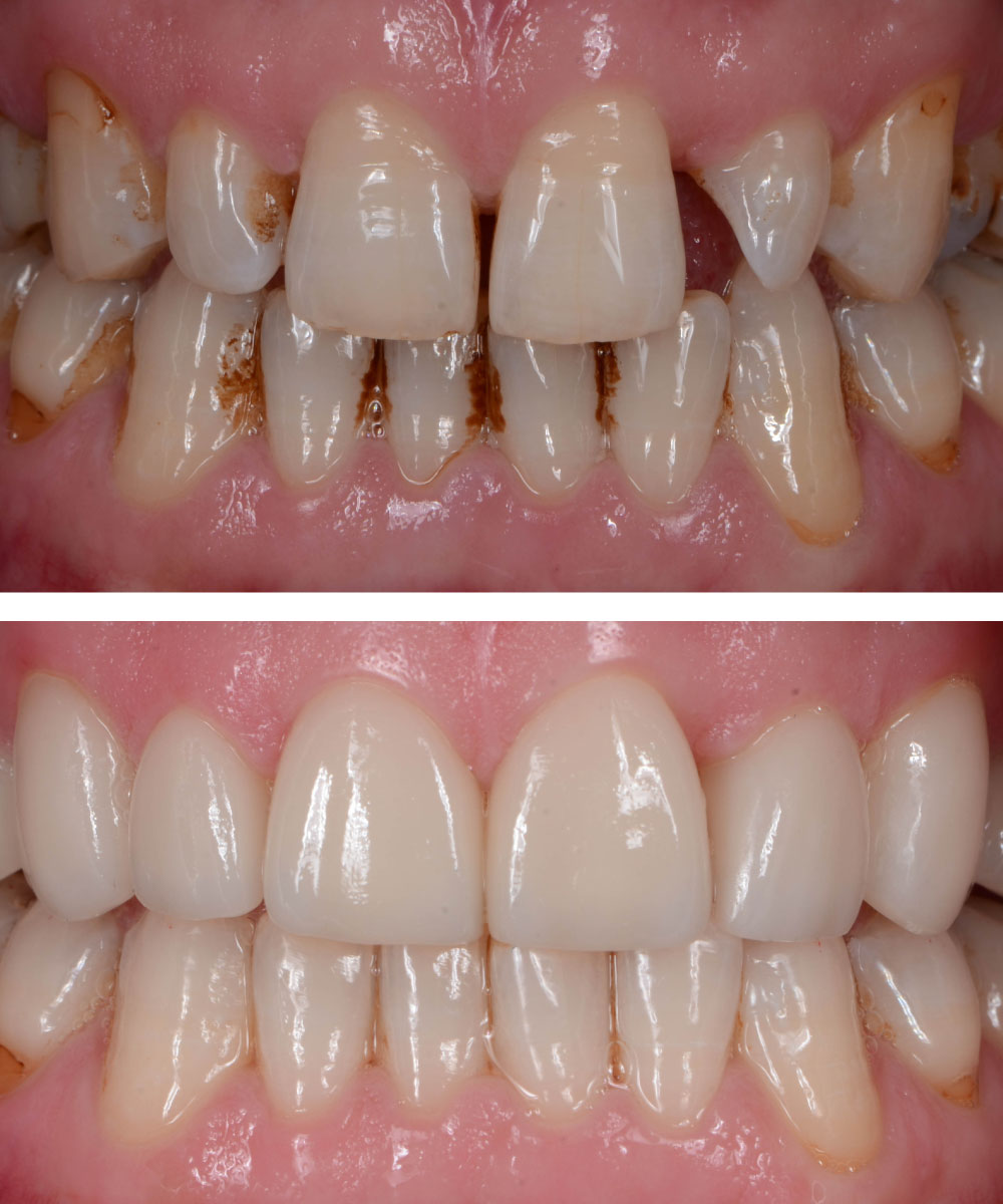 Renton Dentist Office