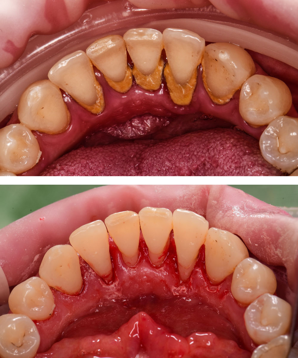 Renton Dentist Office