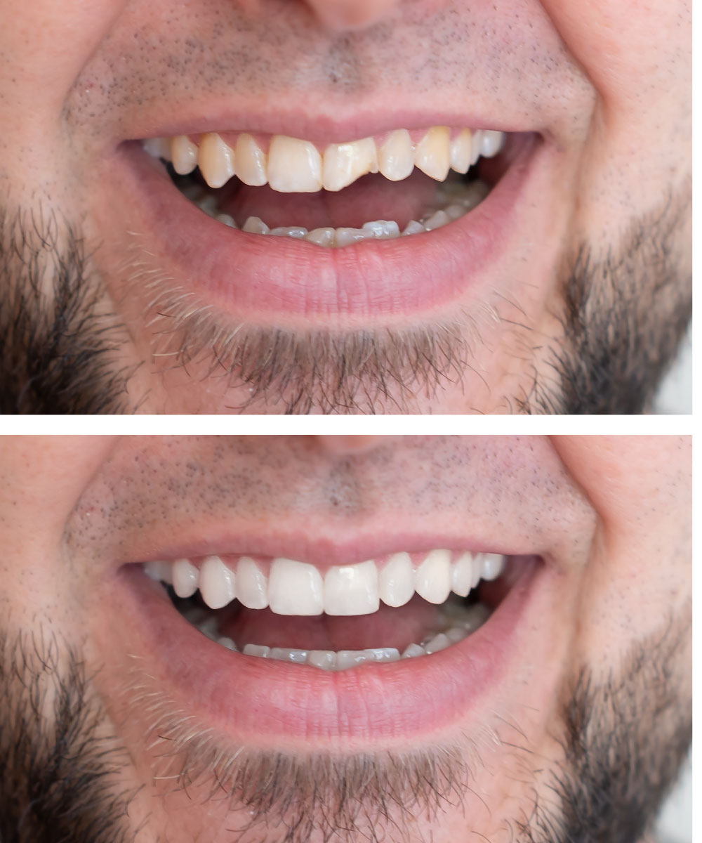 Renton Dentist Office