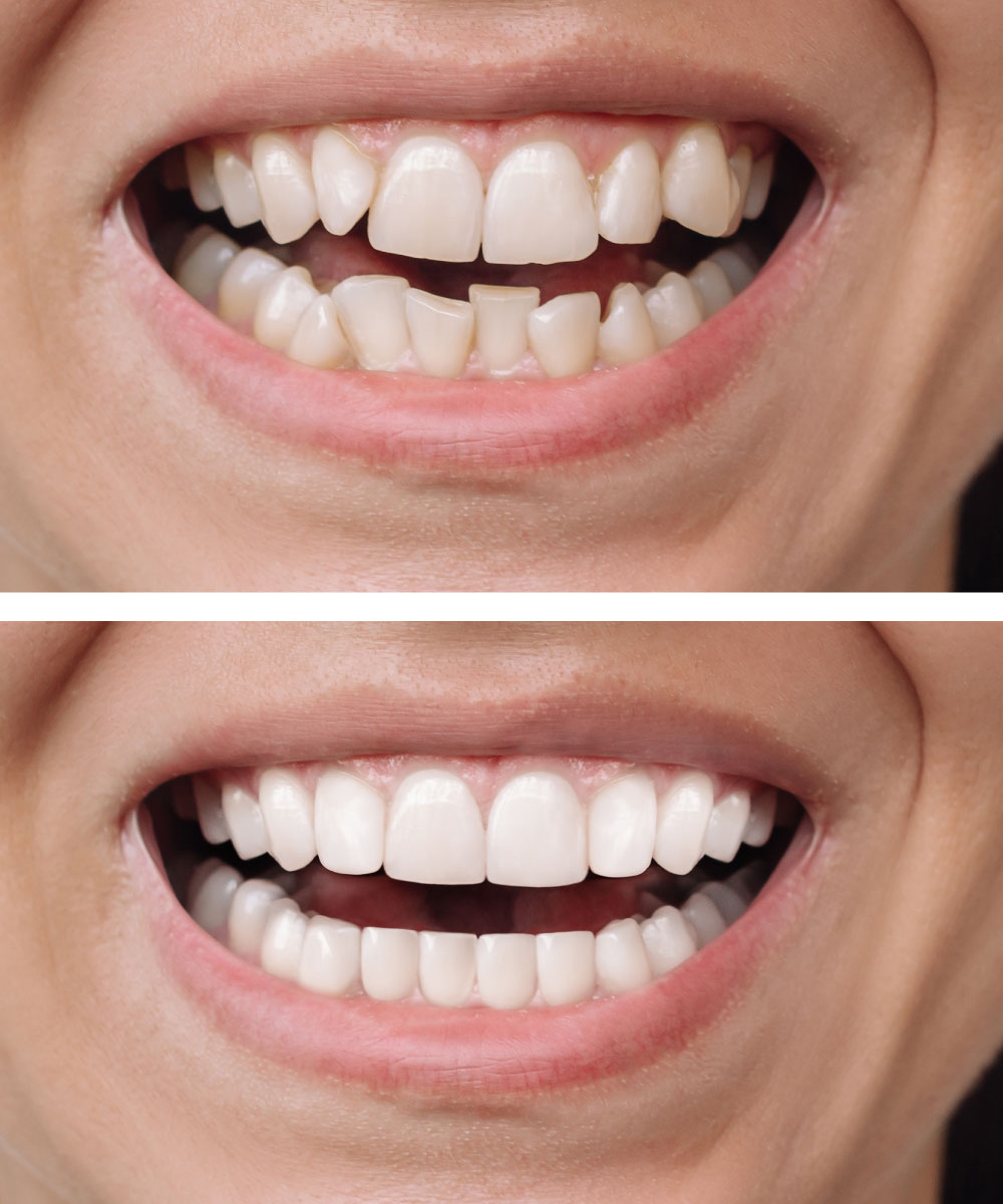 Renton Dentist Office