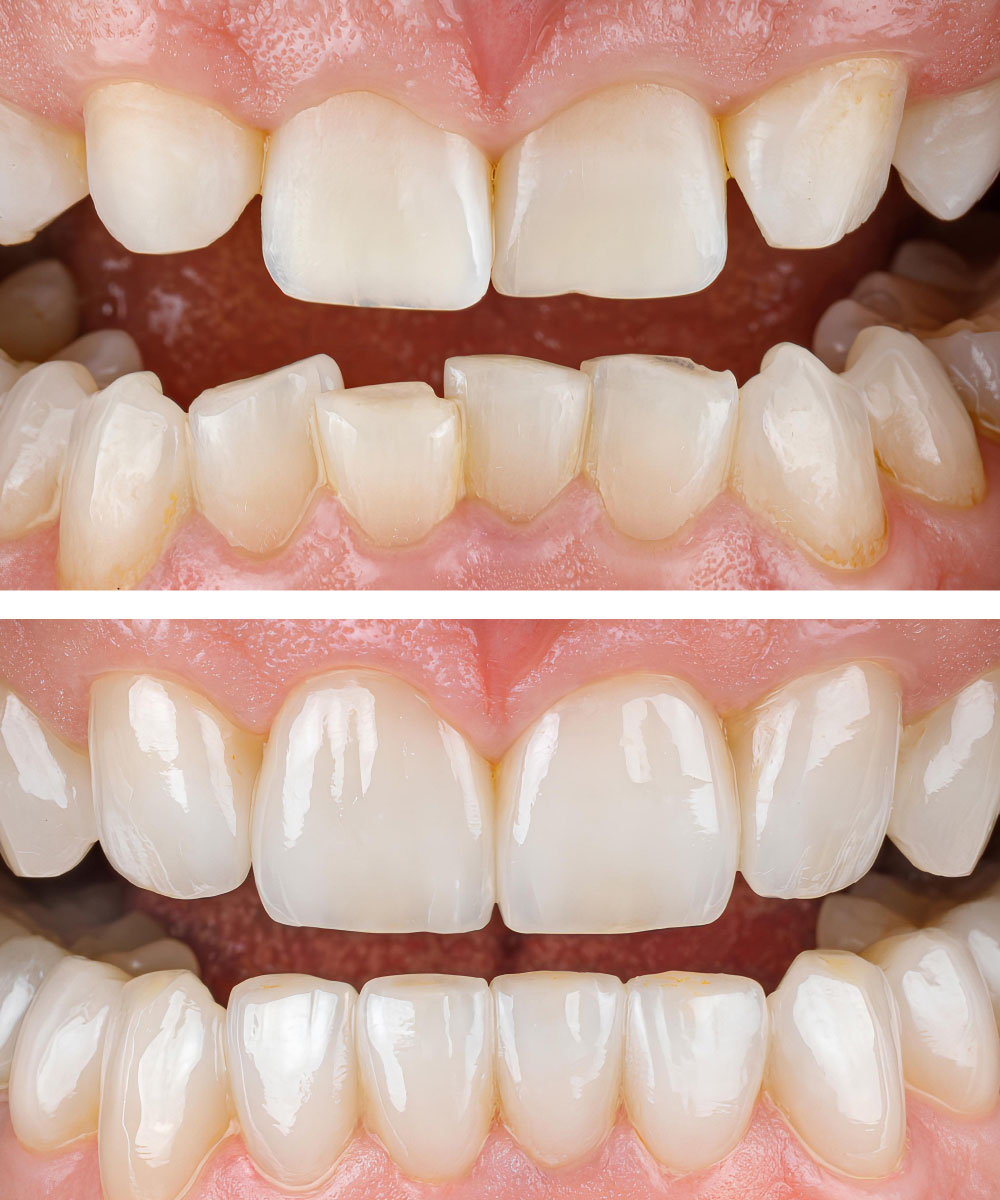 Renton Dentist Office