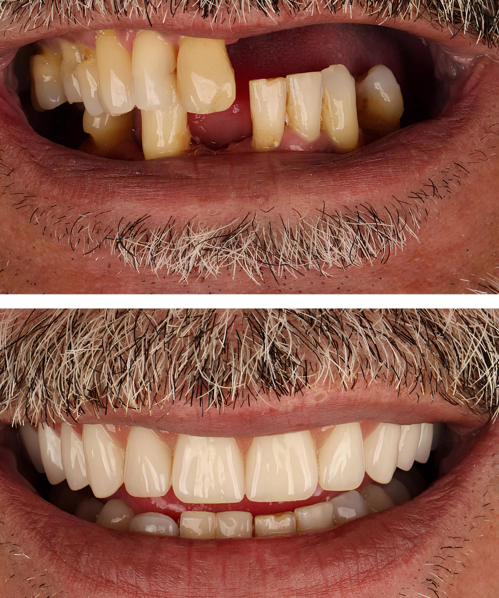 Renton Dentist Office